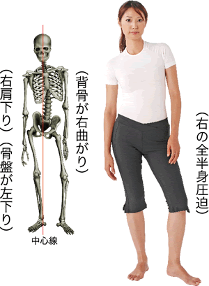 立位正面