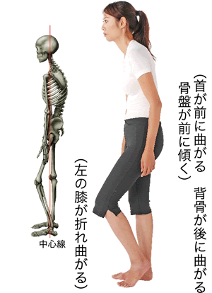 立位側面
