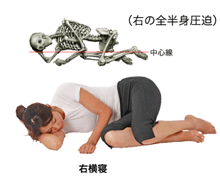 臥位